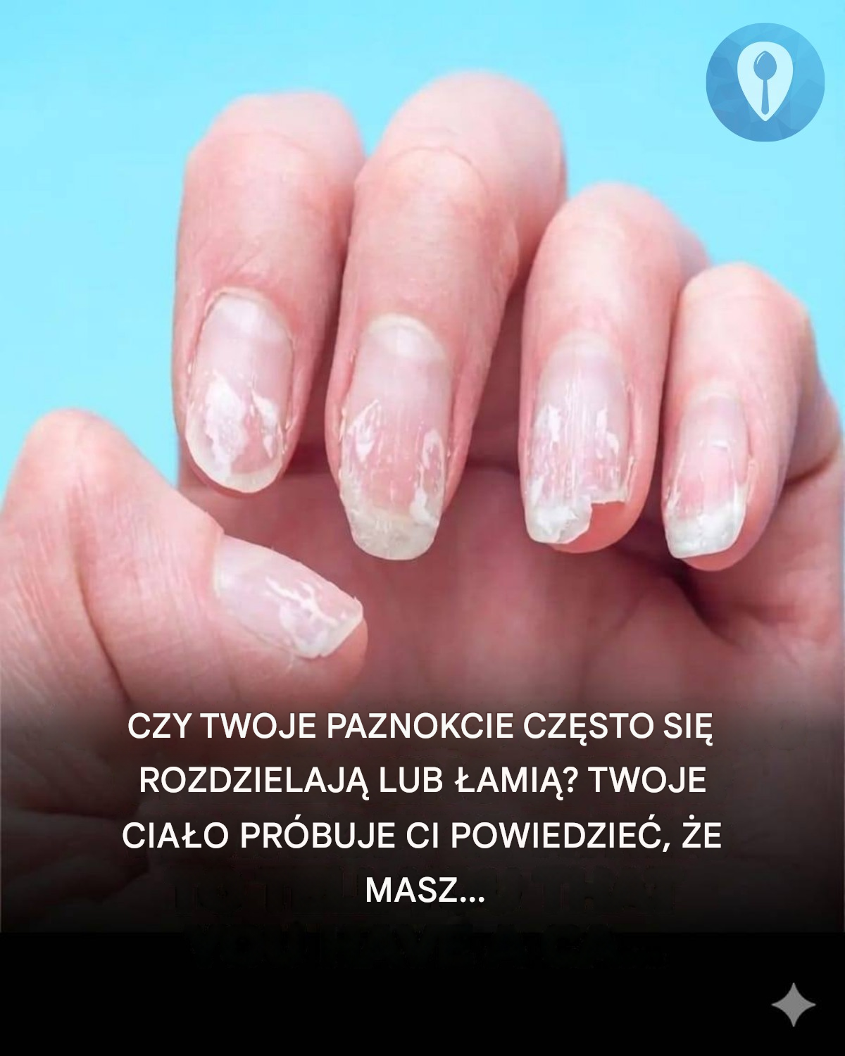 Białe, prążkowane i łamliwe paznokcie: co to może oznaczać?