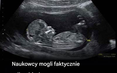 Naukowcy mogli faktycznie odkryć jedną z przyczyn autyzmu