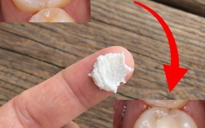 5 prostych naturalnych domowych sposobów na zapobieganie próchnicy i wspieranie zdrowych zębów