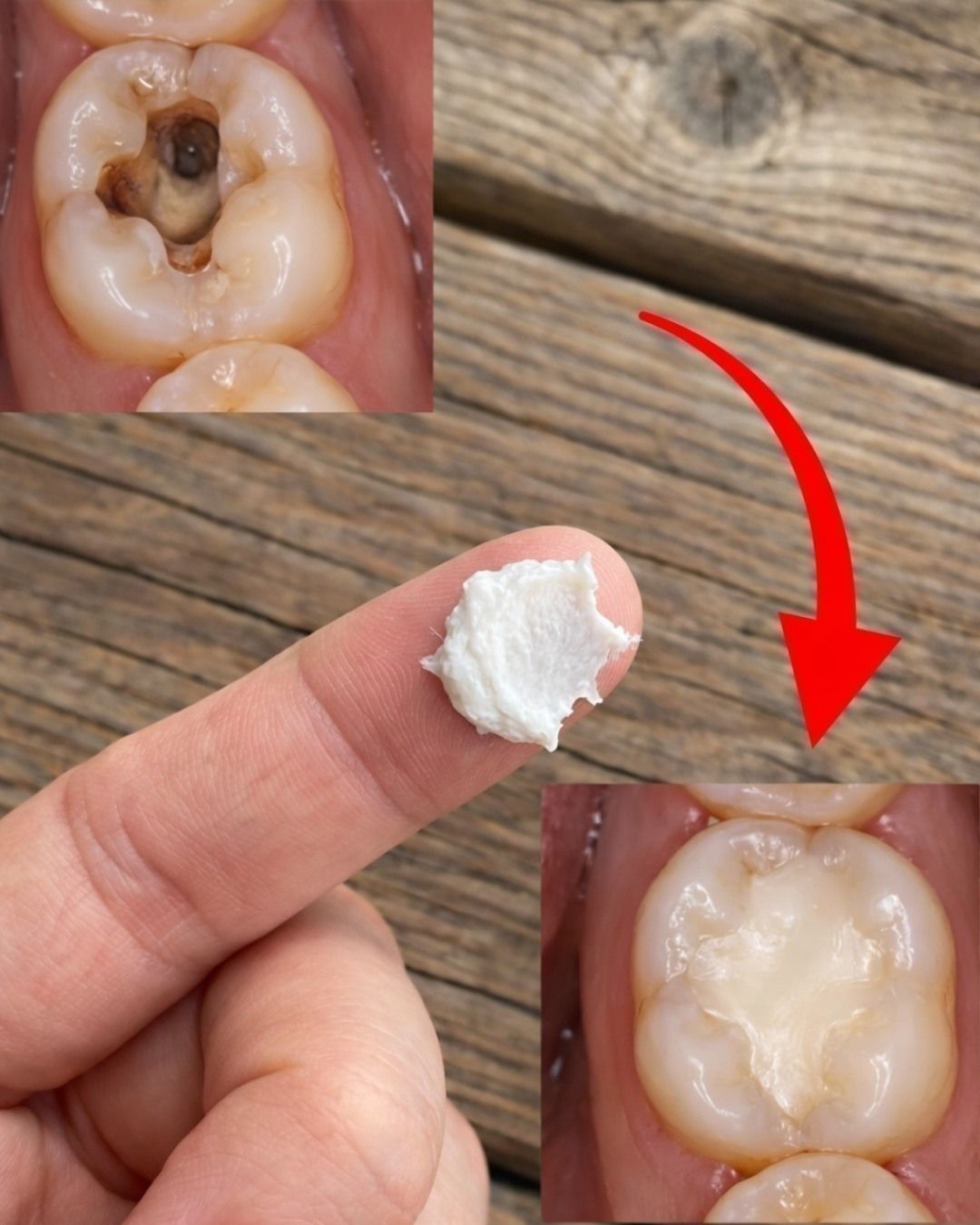 5 prostych naturalnych domowych sposobów na zapobieganie próchnicy i wspieranie zdrowych zębów