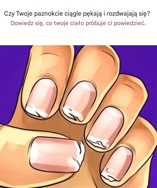 Czy Twoje paznokcie są łamliwe, pękają lub rozdwajają się regularnie? To nie jest błahostka: Twoje ciało wysyła Ci sygnał.