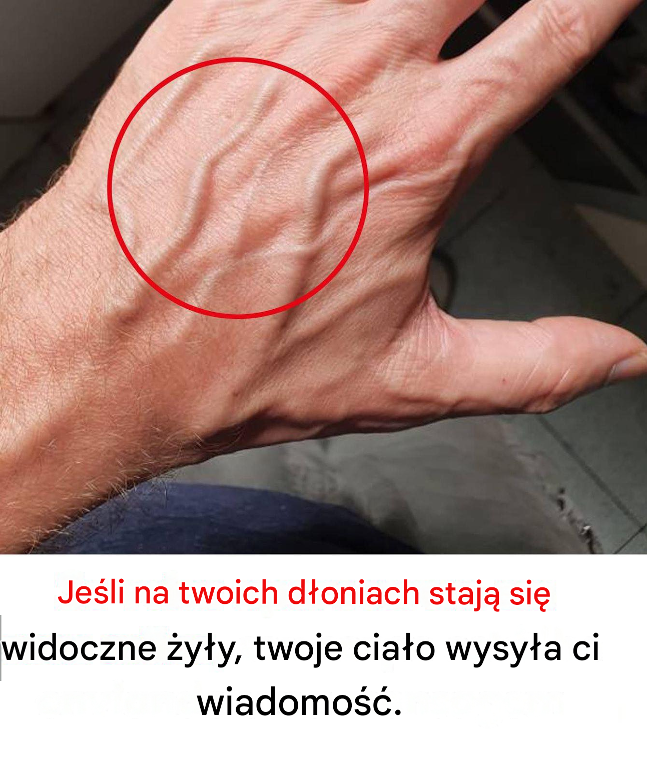 Nagłe pojawienie się żył: kiedy jest to znak ostrzegawczy?