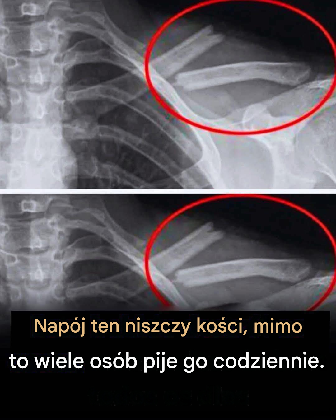 Czy ten płyn niszczy kości? Wiesz, o jakim napoju mówię?