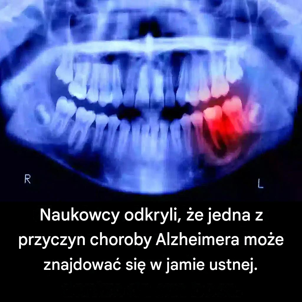 Naukowcy odkryli, że jedna z przyczyn choroby Alzheimera może znajdować się w jamie ustnej.