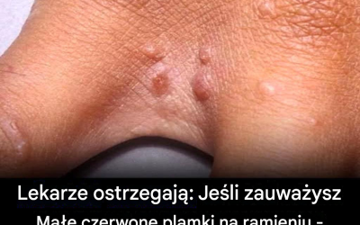 Lekarze ostrzegają: jeśli zauważysz na ramieniu małe czerwone plamki, nie ignoruj ​​tych sygnałów ostrzegawczych.