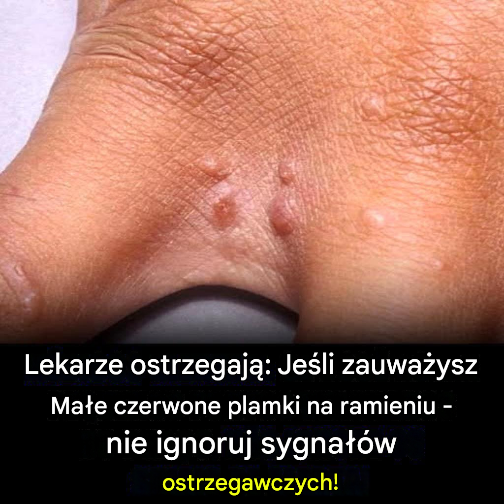Lekarze ostrzegają: jeśli zauważysz na ramieniu małe czerwone plamki, nie ignoruj ​​tych sygnałów ostrzegawczych.