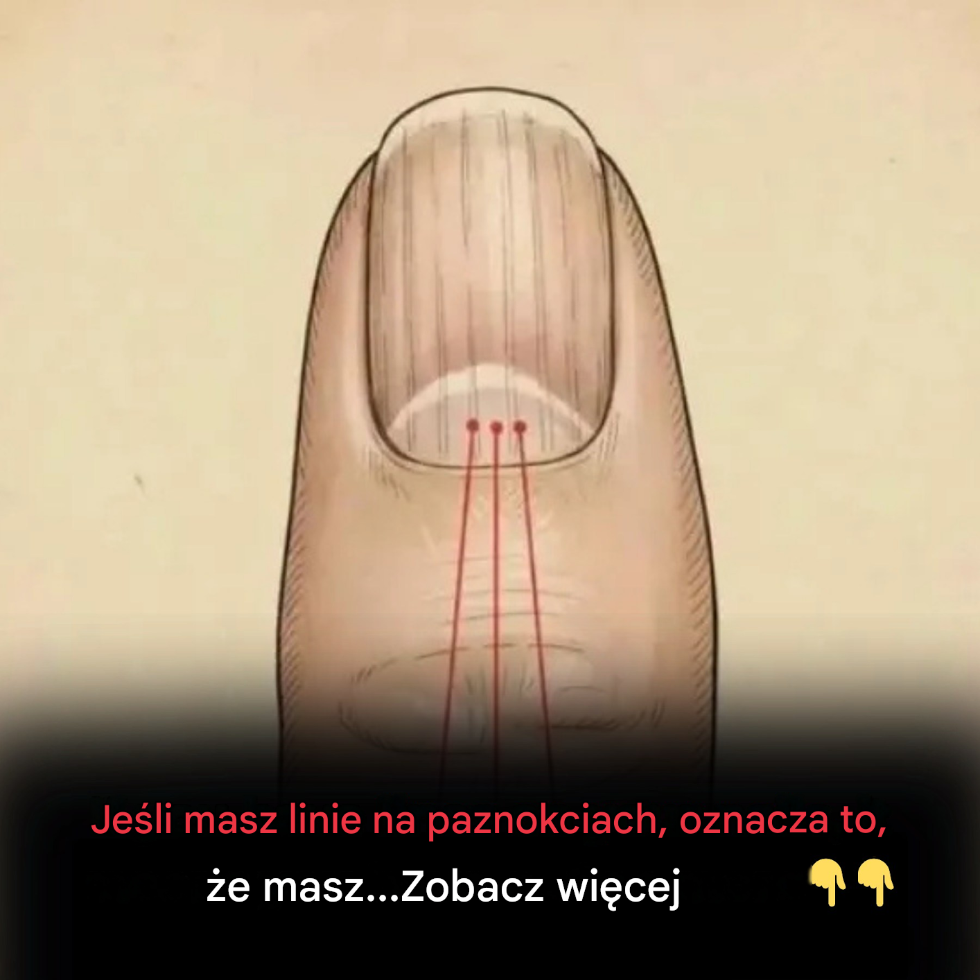 Jeśli masz linie na paznokciach, oznacza to, że masz…