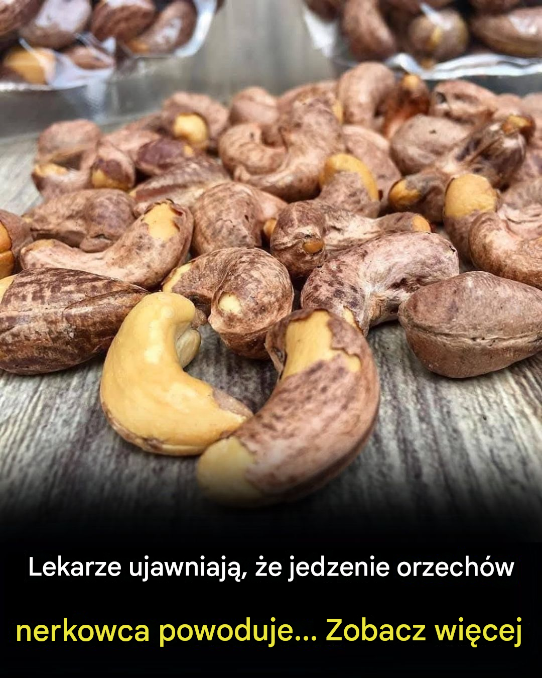 Lekarze ujawniają, że spożywanie orzechów nerkowca powoduje…